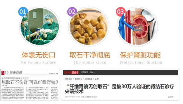 只需一分钟教你全面认识肾结石(图5)