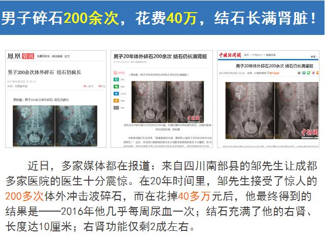 肾结石如何排出？(图3)