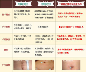 胆囊息肉的保守治疗法(图2)