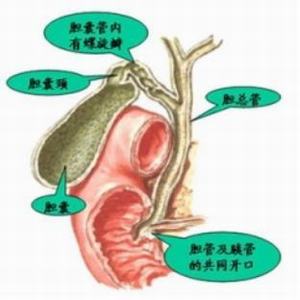 胆囊炎的形成因素有哪些？(图1)