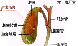 胆总管结石是怎么形成的(图1)