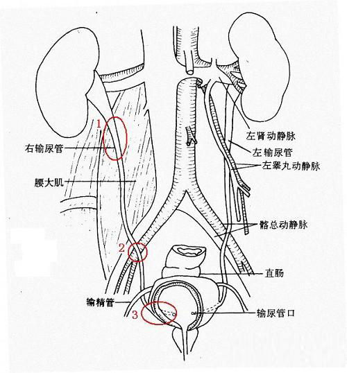 输尿管结石治疗大概要多少钱(图1) 输尿管结石治疗大概要多少钱(图1)