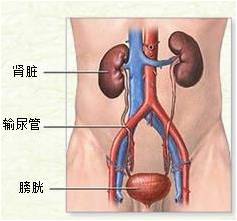 怎么排出肾结石(图1)