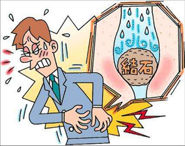 关于肾结石不得不知道的几件事(图2)