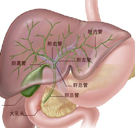 肝内胆管结石治疗费用如何？(图1)