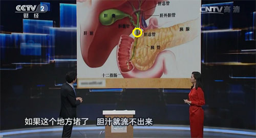 结石怎么来不重要，怎么取出才重要(图2)